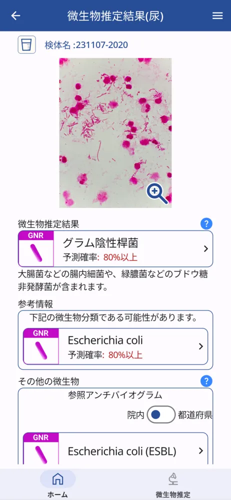 １０秒で菌種推定結果が表示されます
