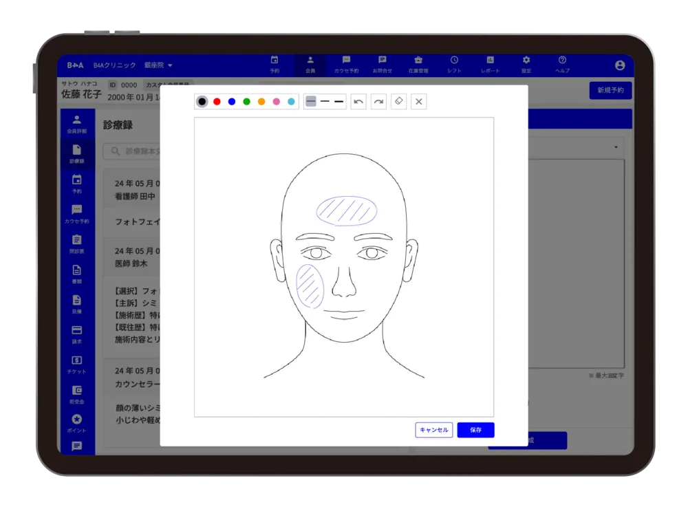 カルテ画面のイメージ
